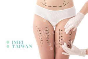 Read more about the article 【私密處保養】2025年私密微創治療趨勢、療效與風險評估