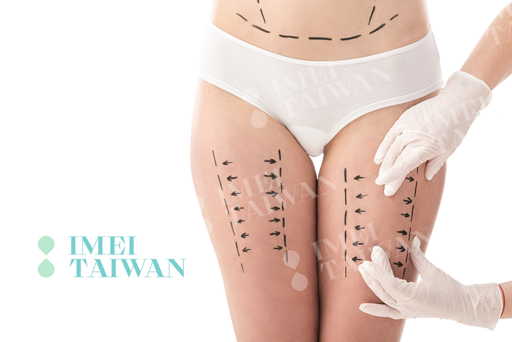 You are currently viewing 【私密處保養】2025年私密微創治療趨勢、療效與風險評估