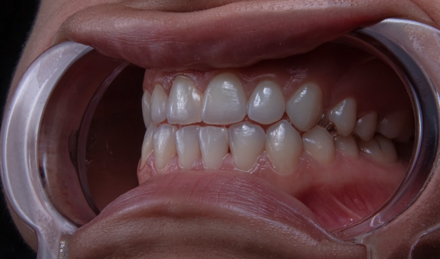 dental aesthetics