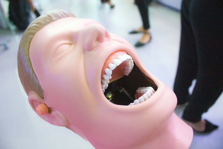 full mouth reconstruction