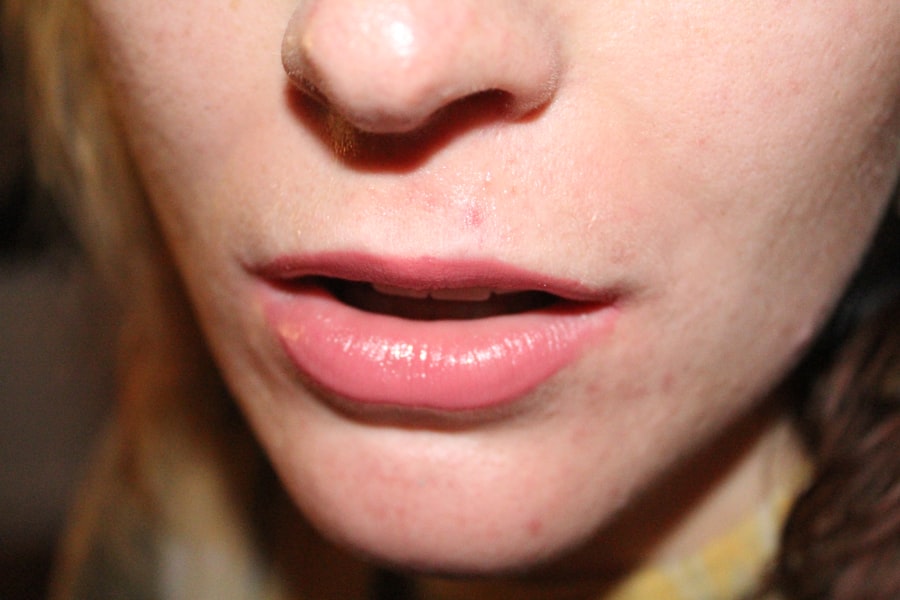pores