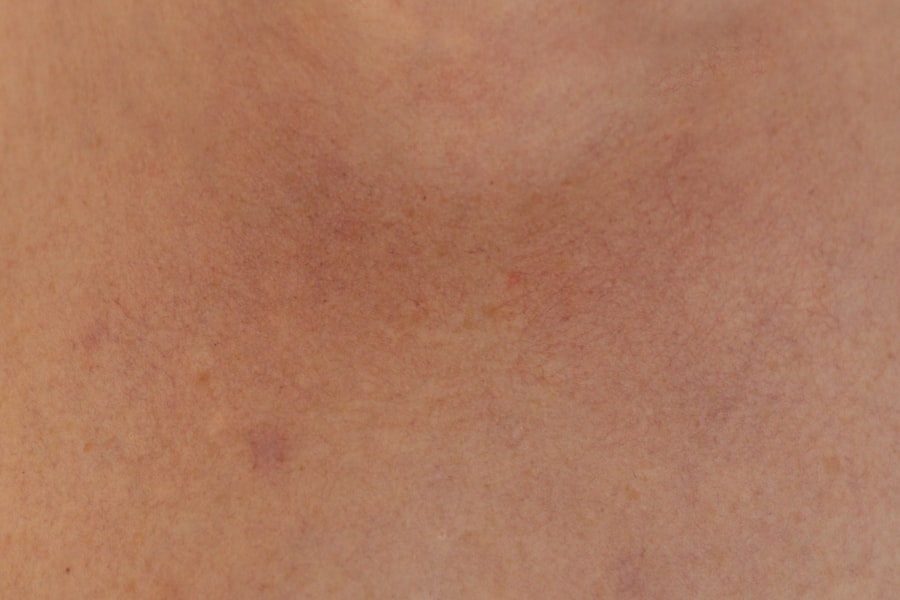 pores
