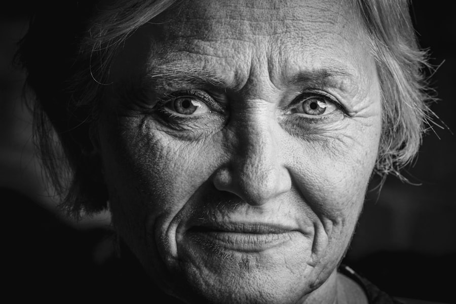 eye wrinkles