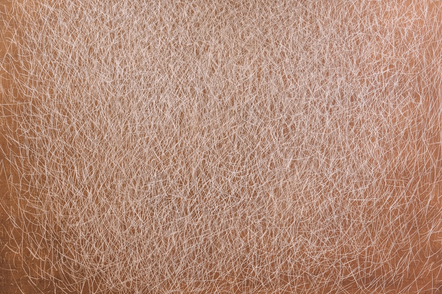 Skin Boosters
