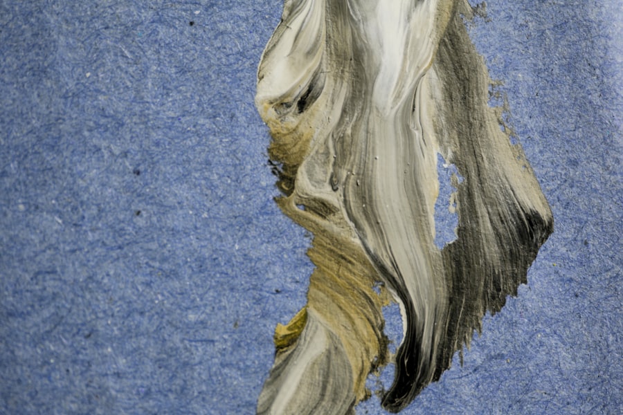 Photo hair transplant