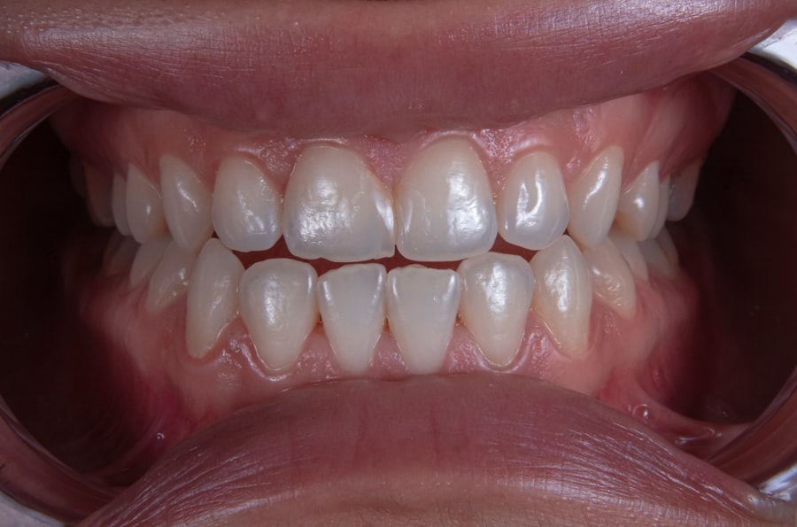 Photo dental aesthetics