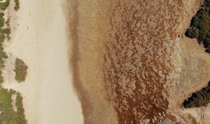 Read more about the article 【杏仁酸換膚】杏仁酸換膚是什麼？功效、副作用與術後照護詳解