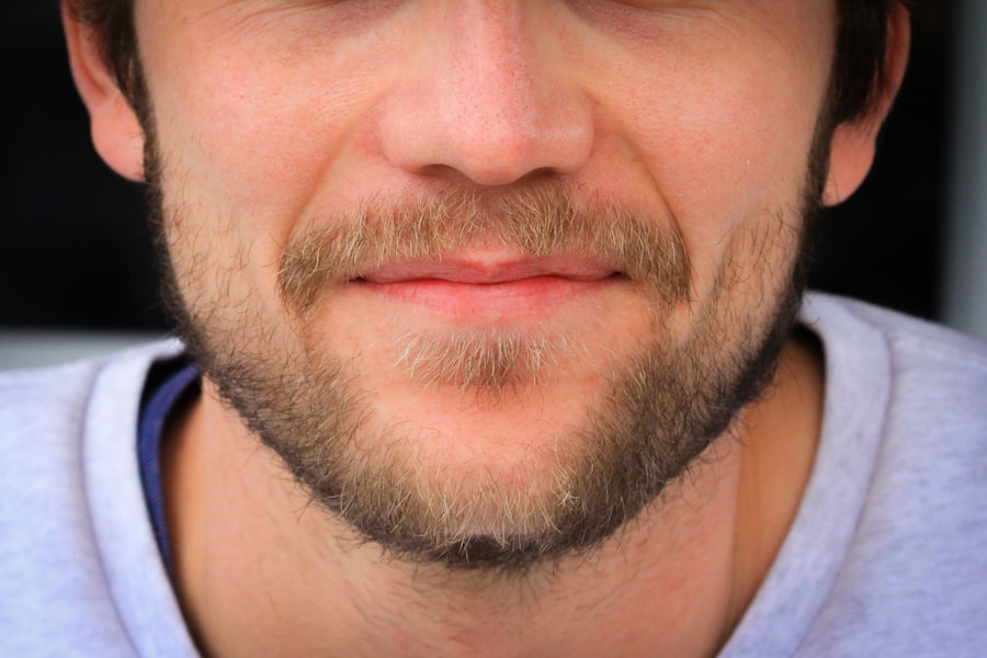Photo pores
