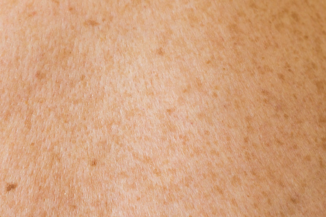 You are currently viewing 【Skin Boosters】介紹Skin Boosters如何改善皮膚質地、保水與光澤，及適合對象。