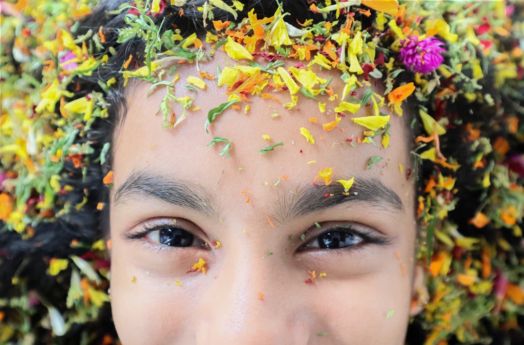 You are currently viewing 【額頭飽滿】額頭飽滿的美學與填充選項：玻尿酸與自體脂肪比較