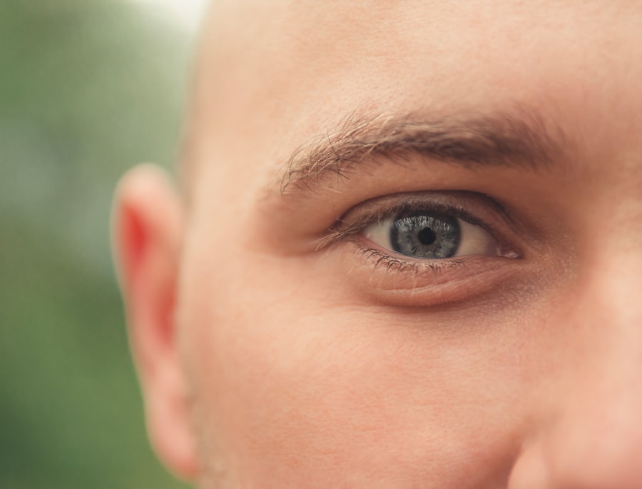 Photo forehead fullness