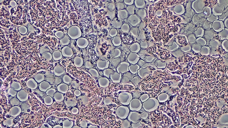 Photo Extracellular Vesicles