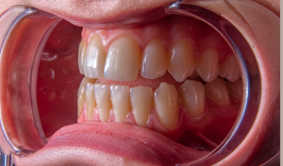 periodontal disease treatment