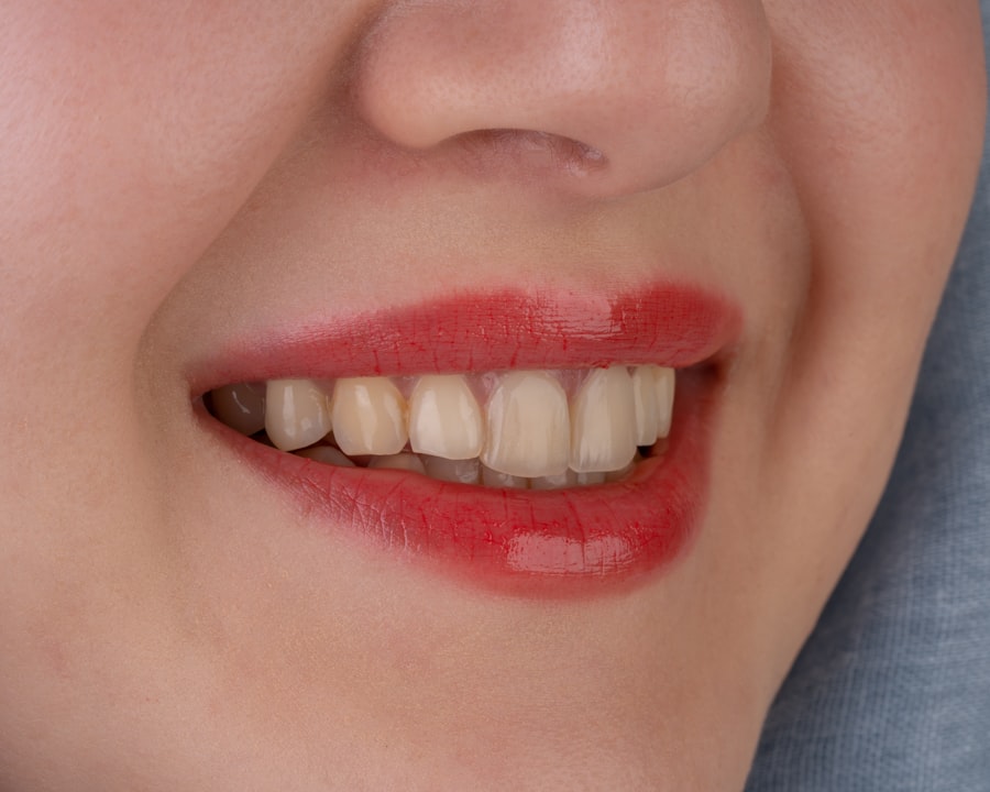 teeth whitening price