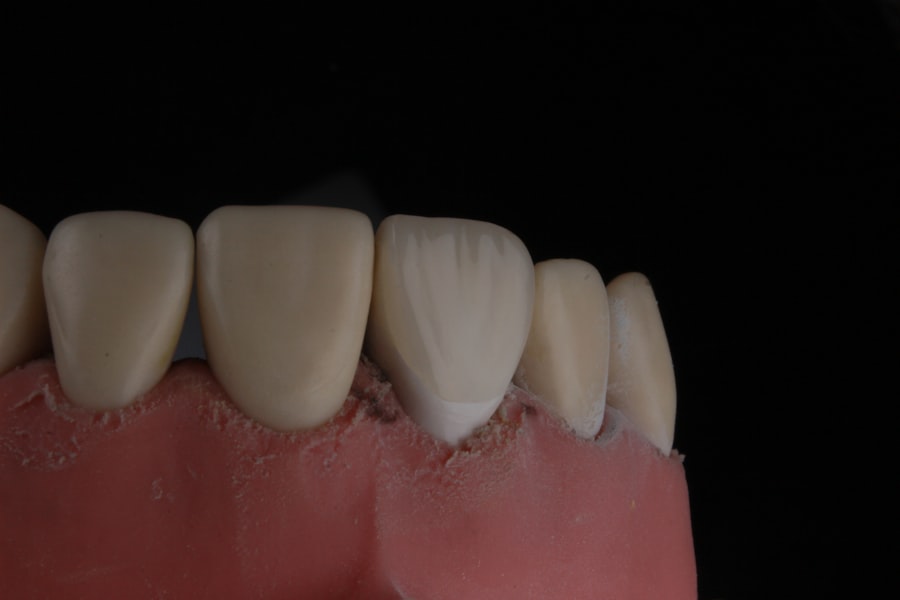 Photo dental implant timeline