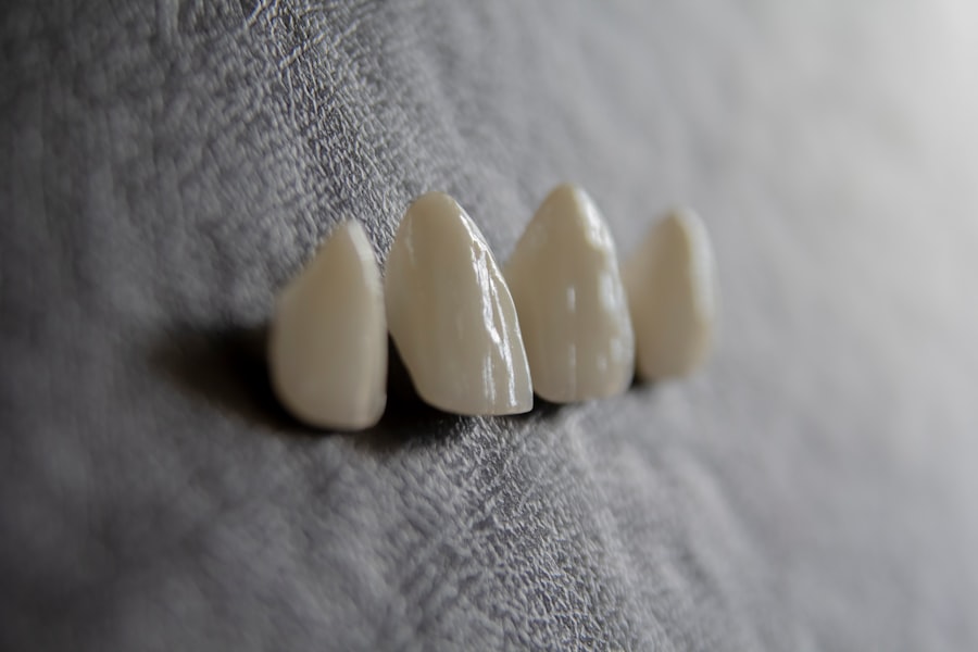 Photo Gum contouring