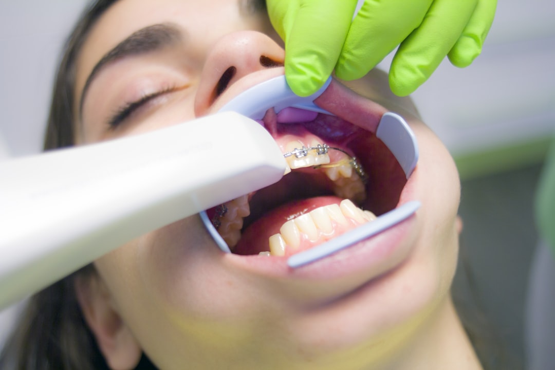 You are currently viewing 【牙齒 美白 價格】牙齒美白價格區間整理：門診與居家方案的費用比較