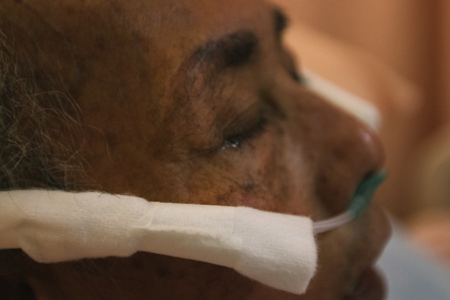 artificial skin replacement