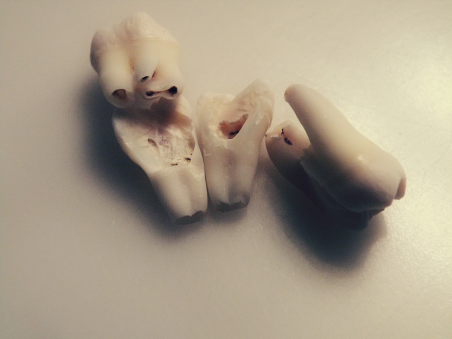 ceramic teeth