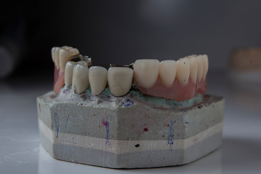 Photo aesthetic orthodontics