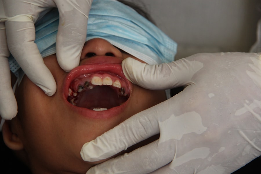 Photo denture fitting