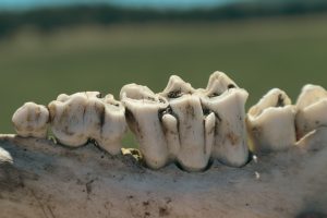 Read more about the article 【牙齒噴砂 價格】牙齒噴砂價格明細：適合哪些族群以及一次治療的費用？