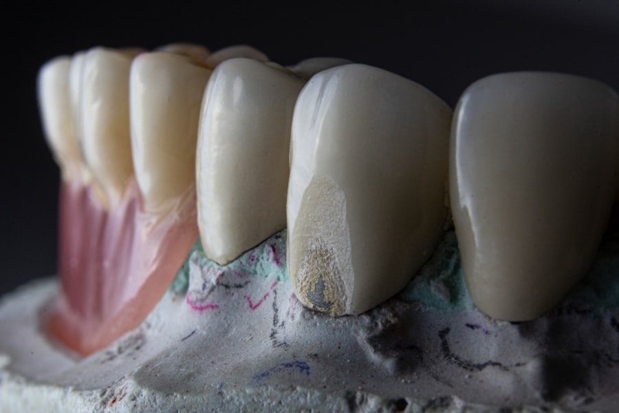 Photo teeth sandblasting price