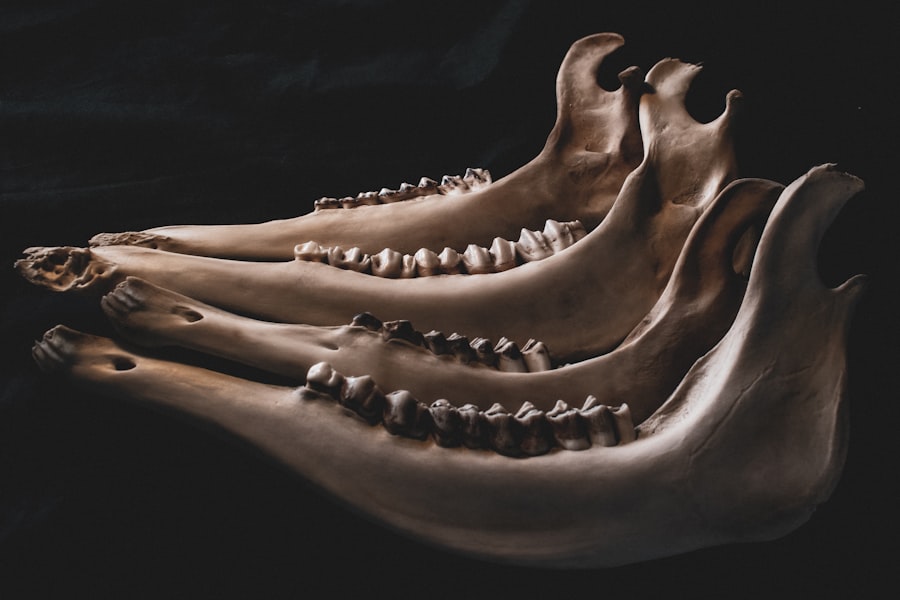 ceramic teeth