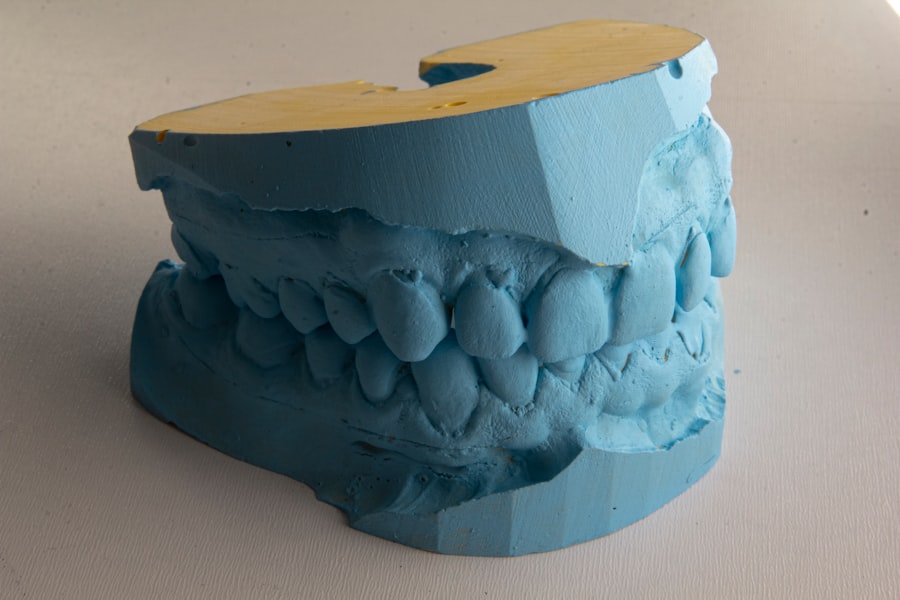 Photo ceramic teeth