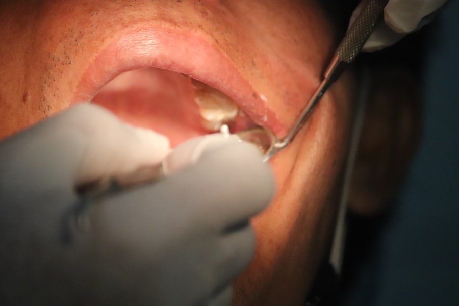 Photo microscopic endodontic therapy