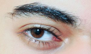 Read more about the article 眼睛看起來沒精神？眼袋手術與提眼瞼肌適應症與恢復期解析