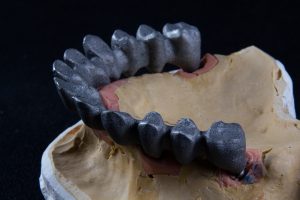 Read more about the article 【陶瓷牙】陶瓷牙的優勢與限制：何時選擇陶瓷修復最合適？