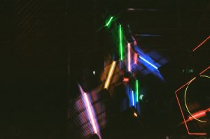 Read more about the article 熊貓眼退散！血管型與色素型黑眼圈的雷射改善之道