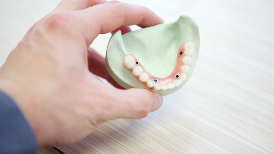 ceramic dental veneers