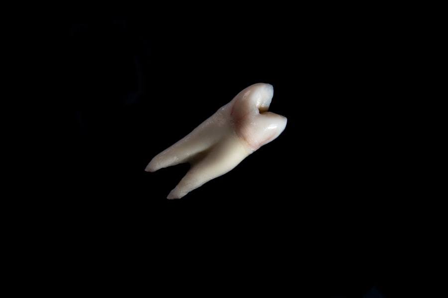 Photo tooth veneer price