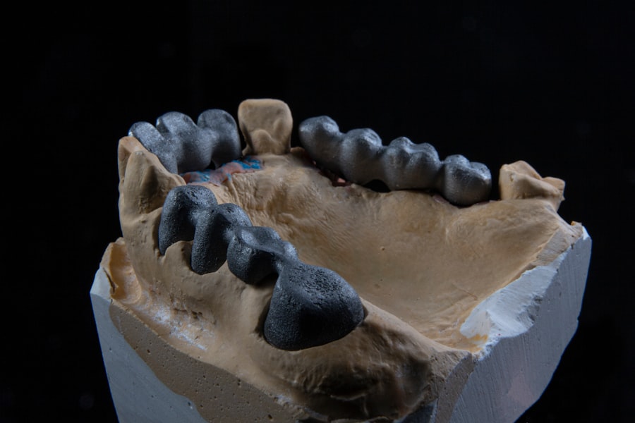 Photo ceramic dental veneers