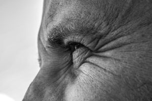 Read more about the article 法令紋醫美怎麼改善最自然？